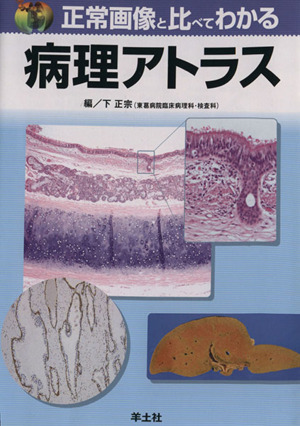 正常画像と比べてわかる 病理アトラス