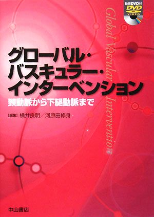グローバル・バスキュラー・インターベンション 頸動脈から下腿動脈まで