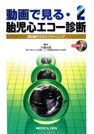 動画で見る・胎児心エコー診断(2) 流出路からのスクリーニング