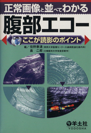 正常画像と並べてわかる 腹部エコー