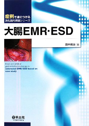 大腸EMR・ESD 症例で身につける消化器内視鏡シリーズ