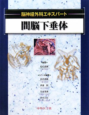 間脳下垂体 脳神経外科エキスパート