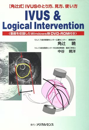 IVUS&Logical Interve