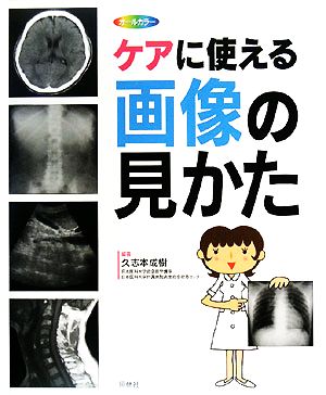 ケアに使える画像の見かた X線写真・CT画像・エコー像・MRI