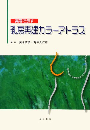 実写で示す乳房再建カラーアトラス