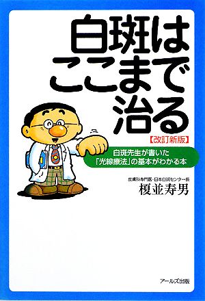 白斑はここまで治る 白斑先生が書いた「光線療法」の基本がわかる本