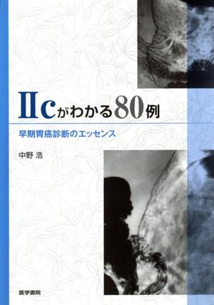 Ⅱcがわかる80例 早期胃癌診断のエッセンス