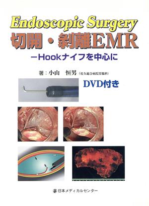 切開・剥離EMR Hookナイフを中心に