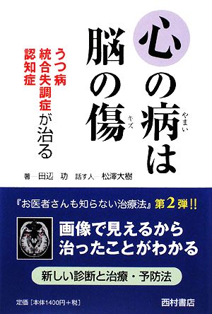 心の病は脳の傷 うつ病・統合失調症・認知症が治る