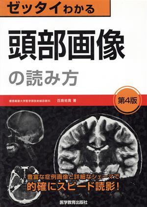 ゼッタイわかる 頭部画像の読み方 第4版