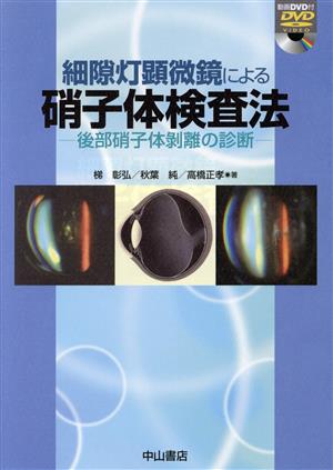 細隙灯顕微鏡による硝子体検査法 DVD付