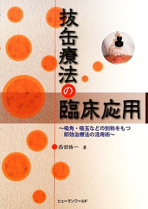 抜缶療法の臨床応用 吸角・吸玉などの別称をもつ即効治療法の活用術