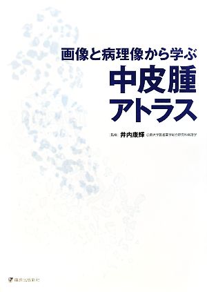 画像と病理像から学ぶ中皮腫アトラス