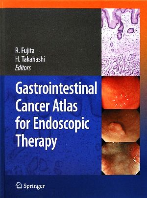 Gastrointestinal Cancer Atlas for Endoscopic Therapy