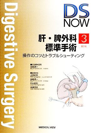 肝・脾外科標準手術 操作のコツとトラブルシューティング Digestive Surgery NOWNo.3