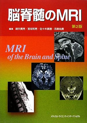 脳脊髄のMRI