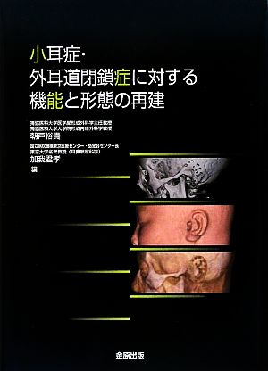 小耳症・外耳道閉鎖症に対する機能と形態の再建