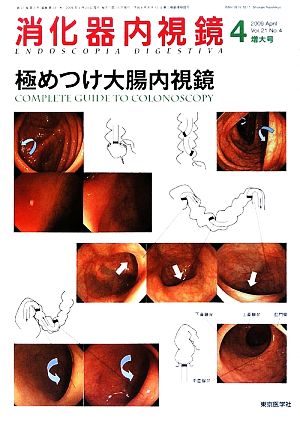 消化器内視鏡(4) 極めつけ大腸内視鏡