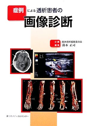 症例による透析患者の画像診断