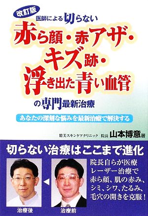 改訂版 医師による切らない赤ら顔・赤アザ・キズ跡・浮き出た青い血管の専門最新治療 あなたの深刻な悩みを最新治療で解決する