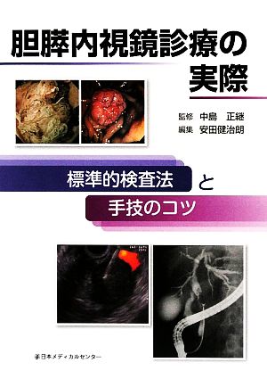 胆膵内視鏡診療の実際標準的検査法と手技のコツ