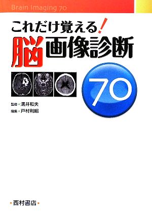 これだけ覚える！脳画像診断70