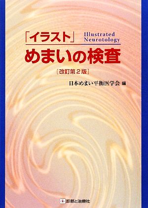 「イラスト」めまいの検査