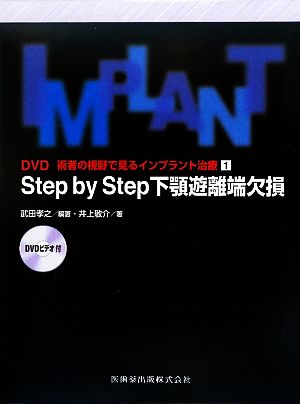 Step by Step下顎遊離端欠損 DVD 術者の視野で見るインプラント治療1