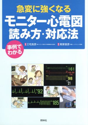 モニター心電図読み方・対応法