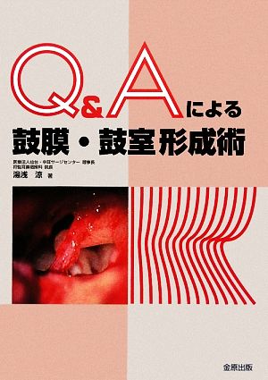 Q&Aによる鼓膜・鼓室形成術