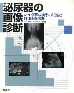 泌尿器の画像診断 いま必要な疾患の知識と