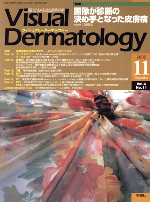 ヴィジュアル・ダーマトロジー(Visual Dermatology)(Vol.4 No.11)