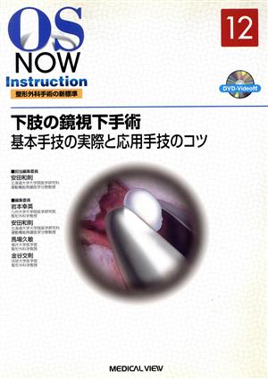 下肢の鏡視下手術 基本手技の実際と応用手