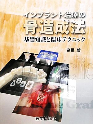 インプラント治療の骨造成法 基礎知識と臨床テクニック