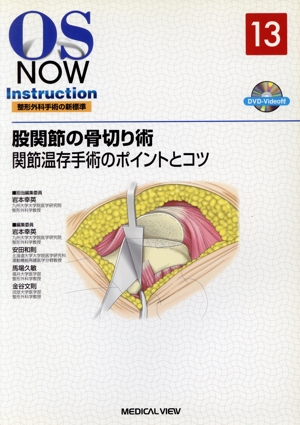 股関節の骨切り術(13) 関節温存手術のポイントとコツ