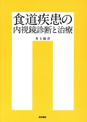 食道疾患の内視鏡診断と治療