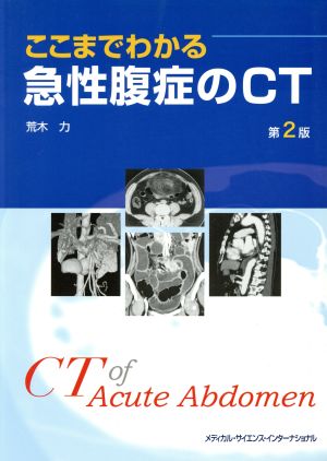 ここまでわかる 急性腹症のCT 第2版