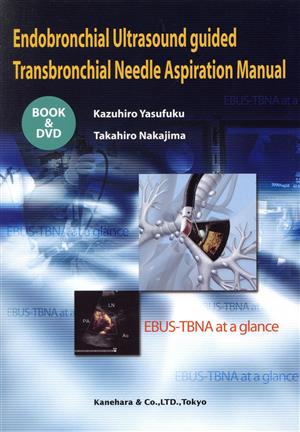 Endobronchial Ultrasound guided Transbronchial Needle Aspiration Manual