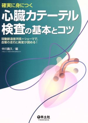 心臓カテーテル検査の基本とコツ 冠動脈造影所見+シェーマで、血管の走行と病変が読める！