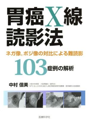 胃癌X線読影法 ネガ像,ポジ像の対比による難読影103症例の解析