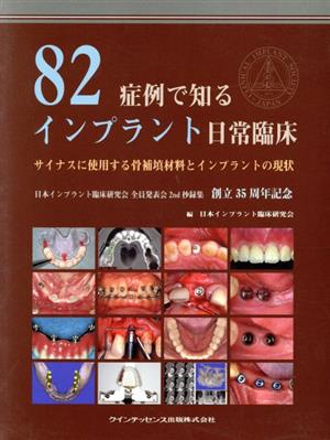 82症例で知るインプラント日常臨床