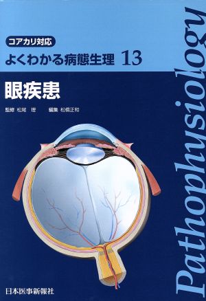 よくわかる病態生理(13)コアカリ対応-眼疾患
