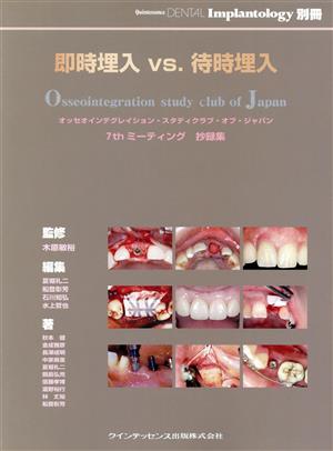 即時埋入vs.待時埋入 オッセオインテグ