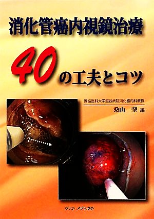 消化管癌内視鏡治療40の工夫とコツ