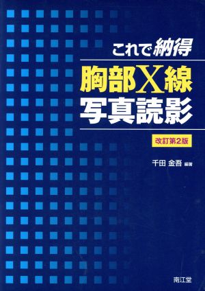 これで納得 胸部X線写真読影 改訂第2版