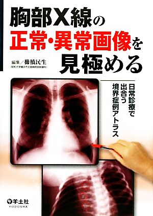 胸部X線の正常・異常画像を見極める 日常で出合う境界症例アトラス