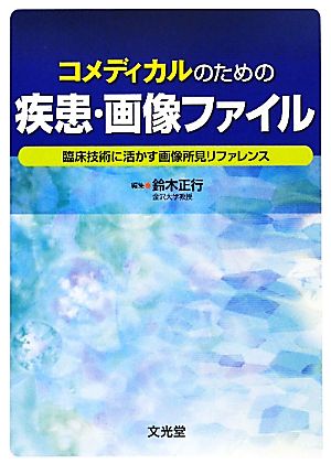 コメディカルのための疾患・画像ファイル 臨床技術に活かす画像所見リファレンス