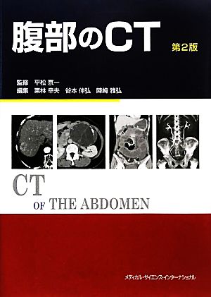 腹部のCT