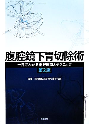 腹腔鏡下胃切除術 一目でわかる術野展開とテクニック