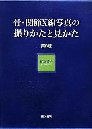 骨・関節X線写真の撮りかたと見かた